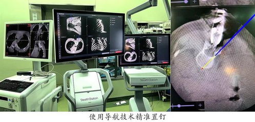 導(dǎo)航系統(tǒng)助兒童脊柱手術(shù)更精準(zhǔn) 復(fù)旦兒科暑期手術(shù)刷新記錄